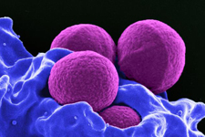 Microscopic view of Staphylococcus aureus showing ball-formed germs on a bed of blue